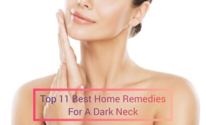Home remedies for a dark neck 