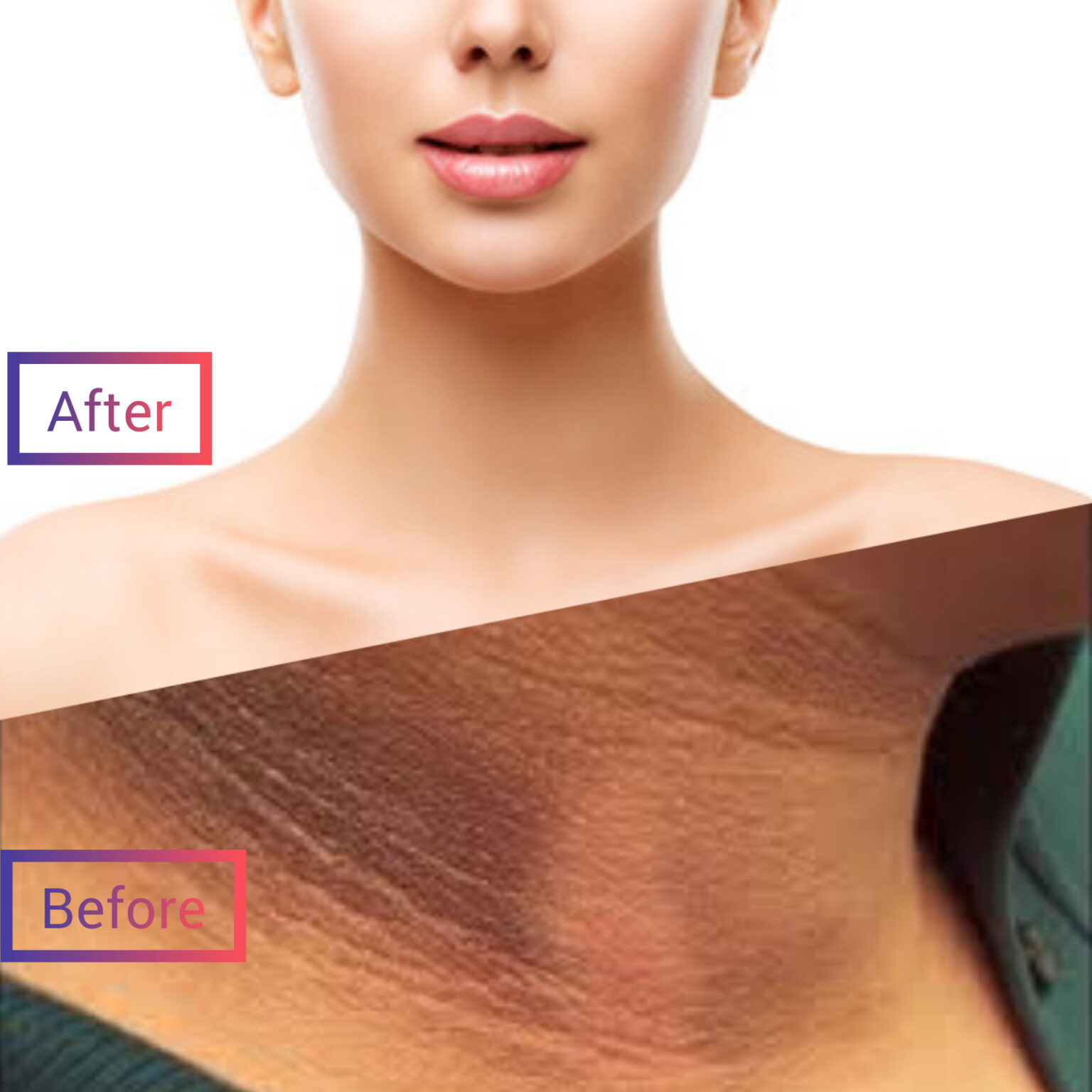 Most Effective Home Remedies For A Dark Neck Switsmell 