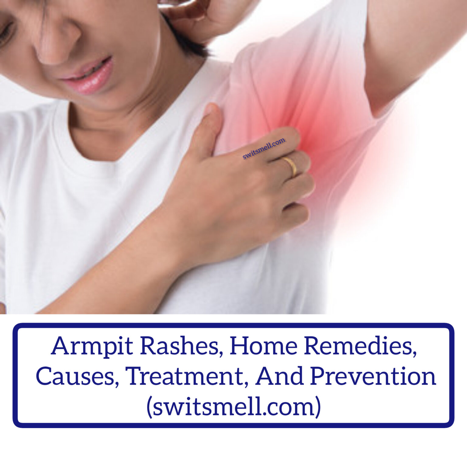 Armpit Rashes Home Remedies, Causes, Treatment, And Prevention